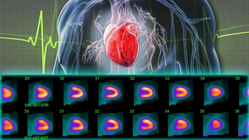 Médecine Nucléaire Bracco Imaging France